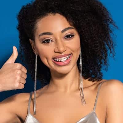 Type of Braces Palo Alto