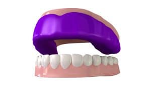 orofacial injuries