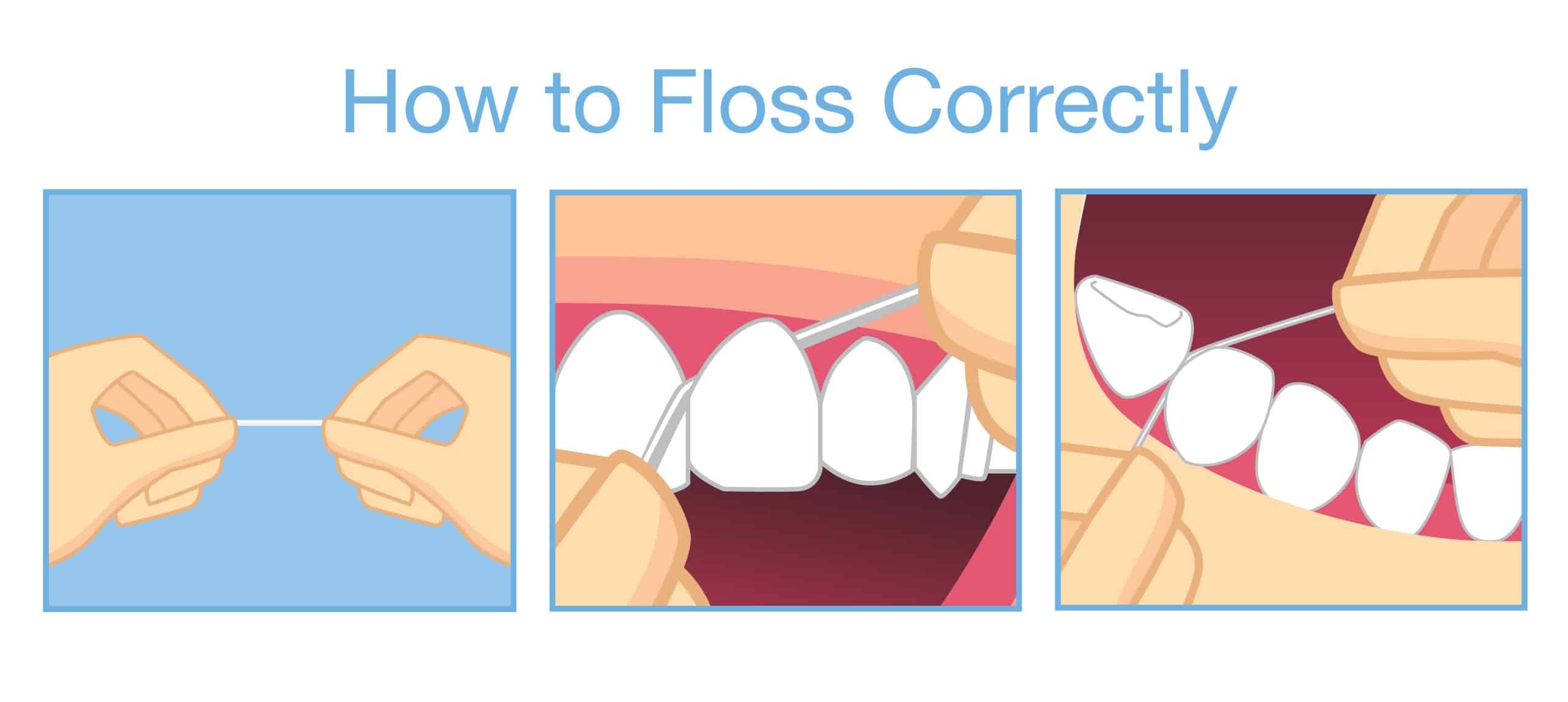 Proper Flossing Technique