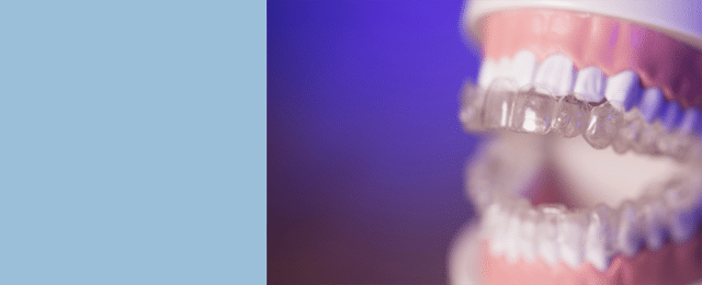 Invisalign Cost in Palo Alto: What You Need to Know from Your Local Orthodontists