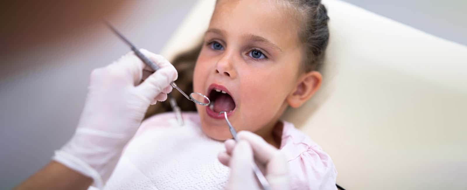 Impacted Canine Treatment: What Parents in Palo Alto Need to Know