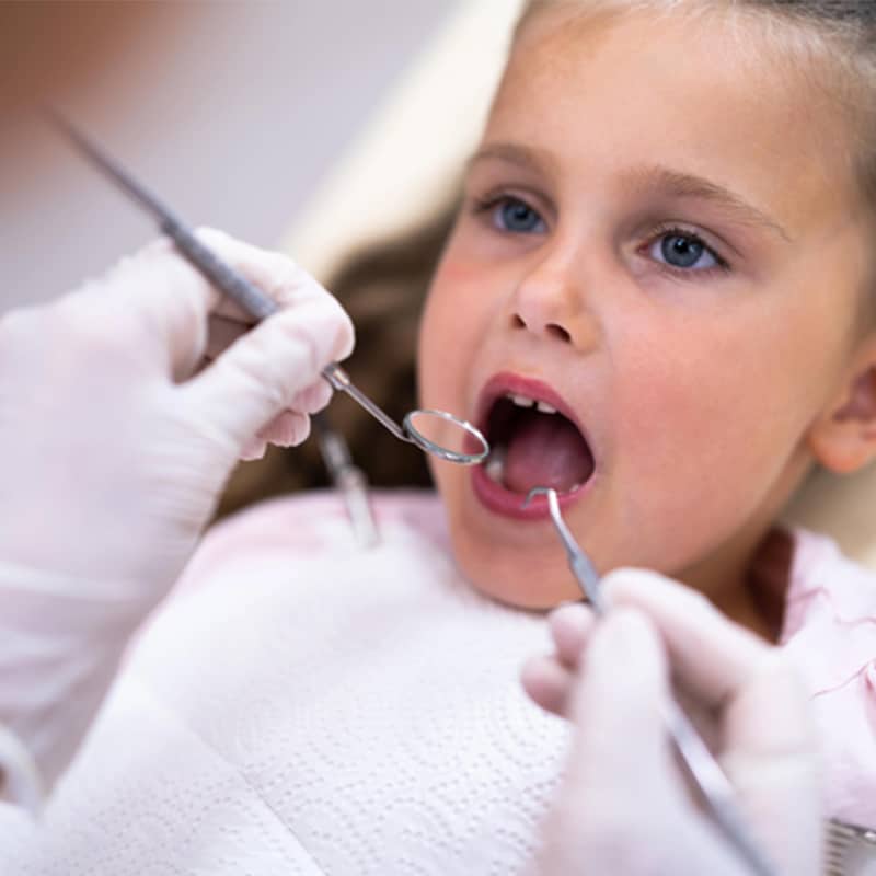 Impacted Canine Treatment: What Parents in Palo Alto Need to Know