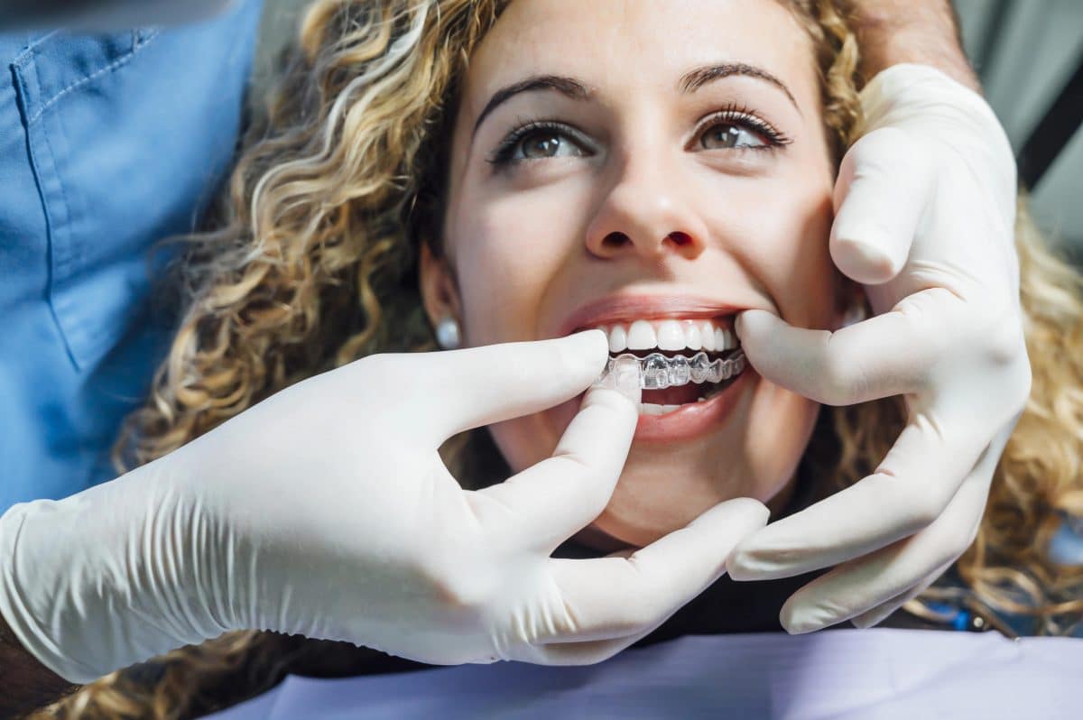 Top 5 Things You Can Do to Be Done with Invisalign on Time