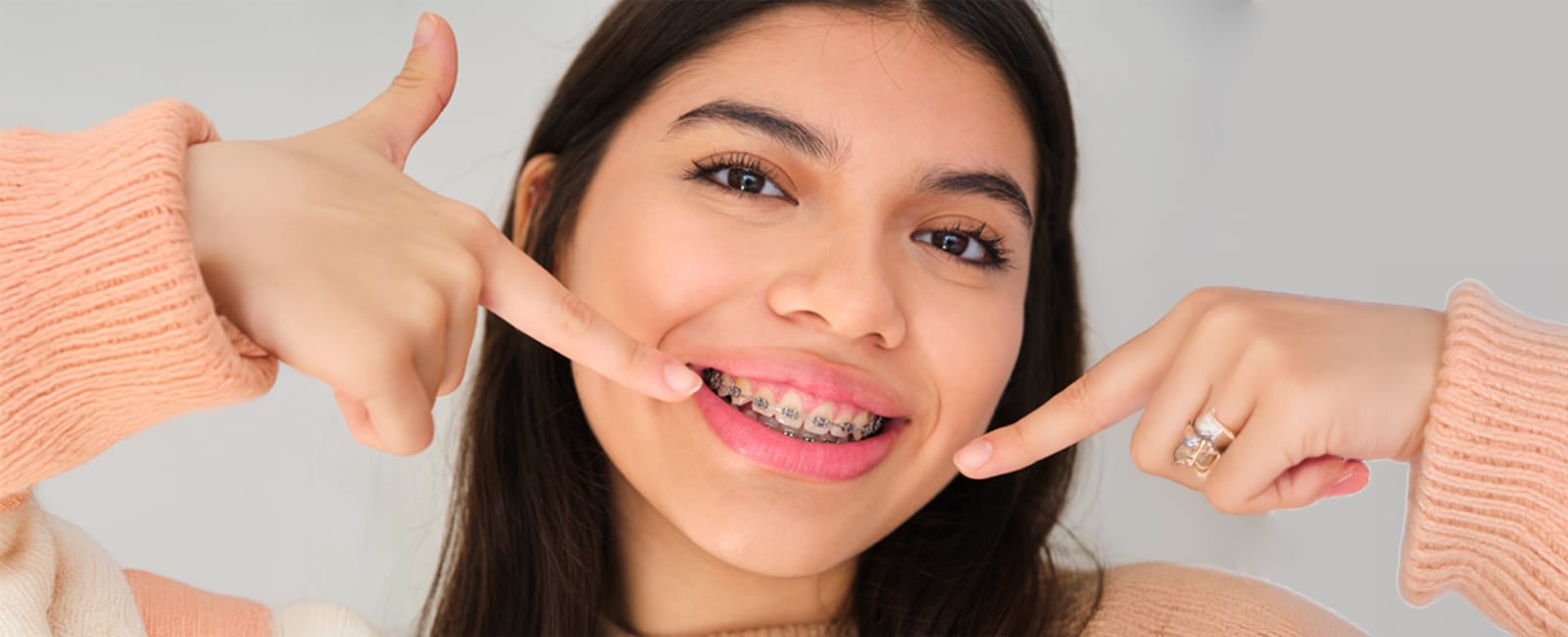 Don’t Fall Behind! 5 Ways to Stay on Track with Braces
