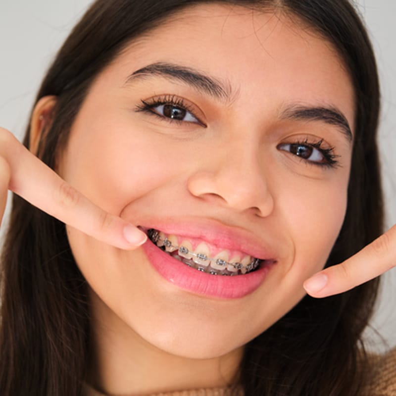 Don’t Fall Behind! 5 Ways to Stay on Track with Braces