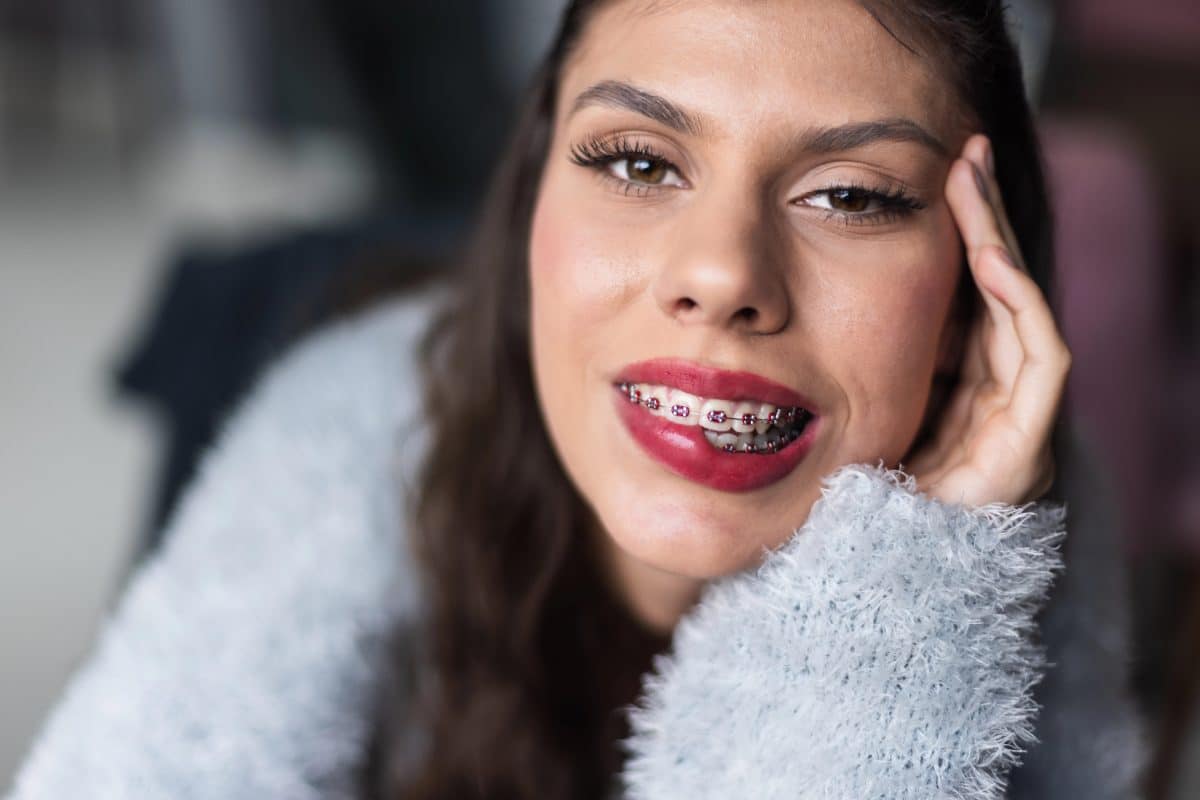 How to Finish Braces on Time: Top Five Things Every Patient Should Know